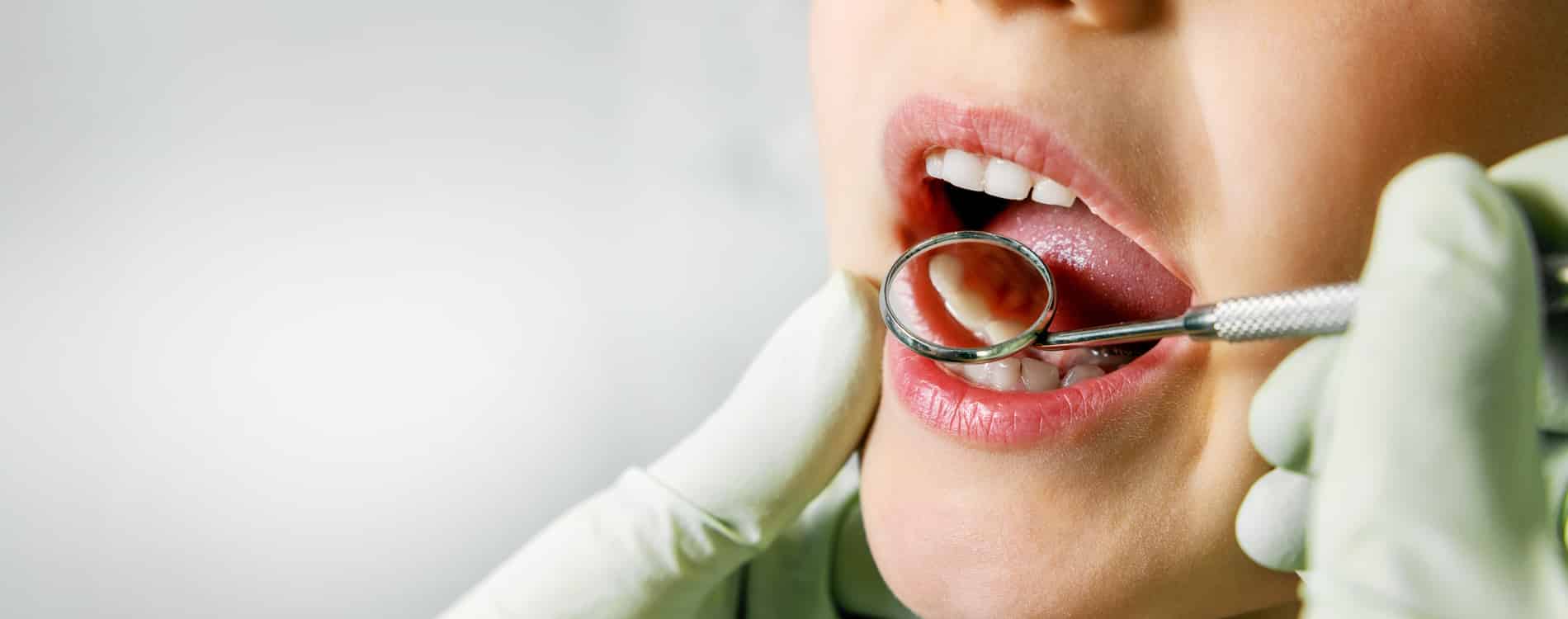 Child at her intial routine dental exam with Dr. Kritika