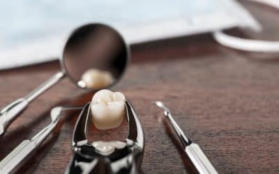 Tooth Extractions 101: What to Expect Before and After in Pacific Grove, CA