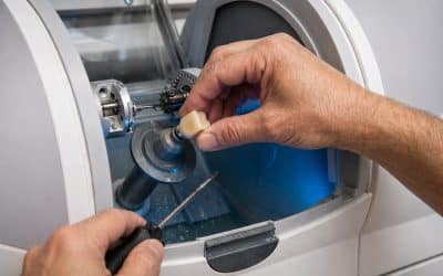 Same-Day Crowns: How Modern Dentistry Saves You Time in Pacific Grove, CA